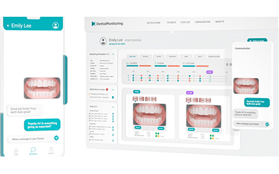 デンタルモニタリング02